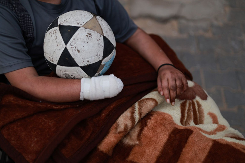 Futbol oynarken bulduğu mühimmatı eve götürdü, elini kaybetti - Resim: 9