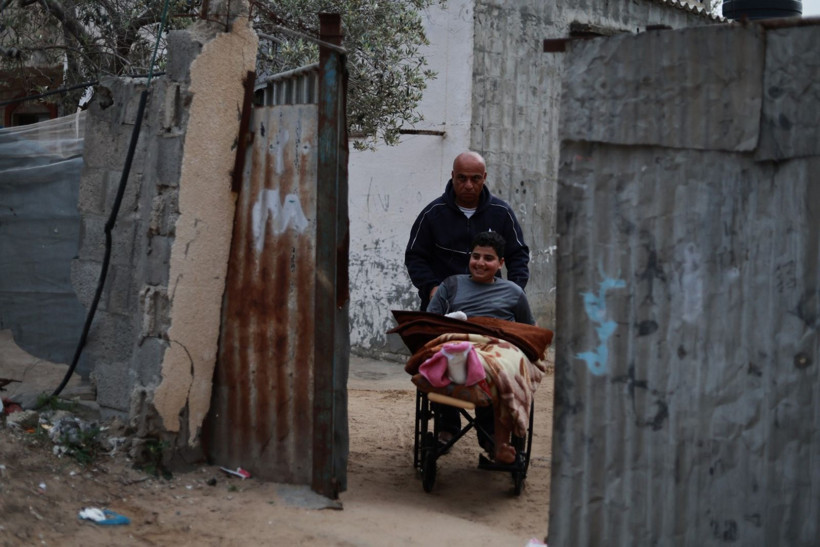 Futbol oynarken bulduğu mühimmatı eve götürdü, elini kaybetti - Resim: 10
