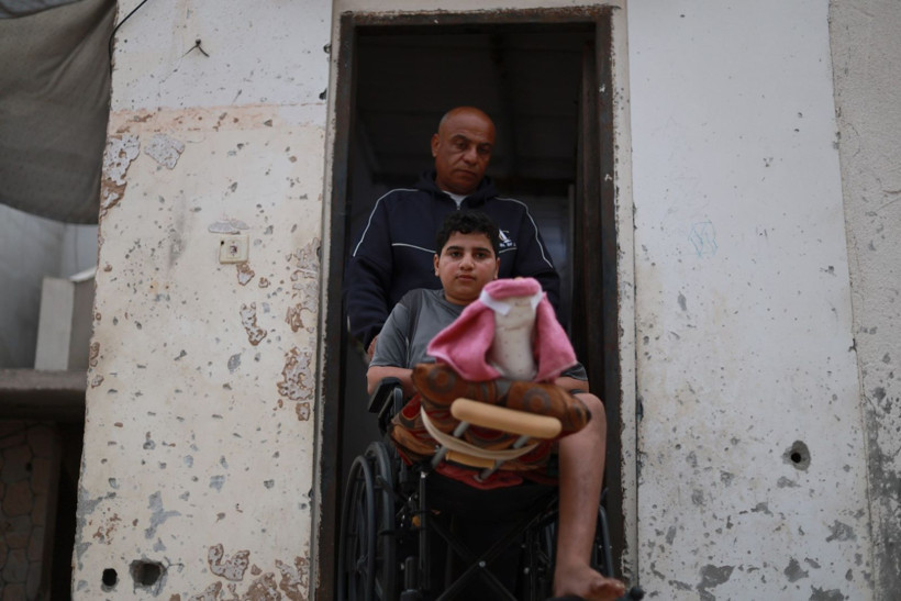 Futbol oynarken bulduğu mühimmatı eve götürdü, elini kaybetti - Resim: 11