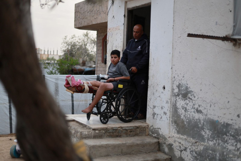 Futbol oynarken bulduğu mühimmatı eve götürdü, elini kaybetti - Resim: 12