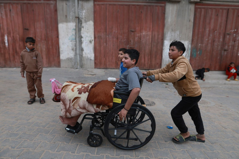 Futbol oynarken bulduğu mühimmatı eve götürdü, elini kaybetti - Resim: 14