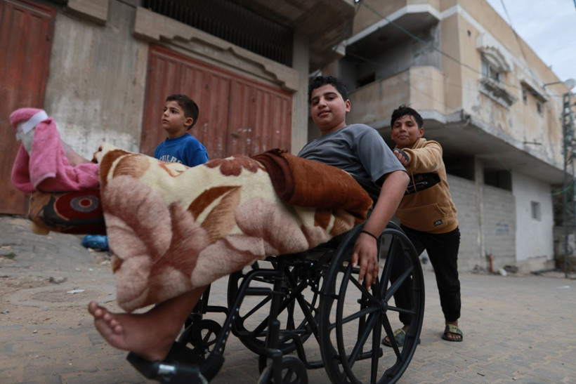 Futbol oynarken bulduğu mühimmatı eve götürdü, elini kaybetti - Resim: 15