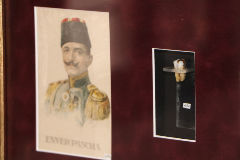Atatürk’ün damak kalıbı, Enver Paşa’nın altın dişi! Bu müze görenleri şaşırtıyor - Resim : 2