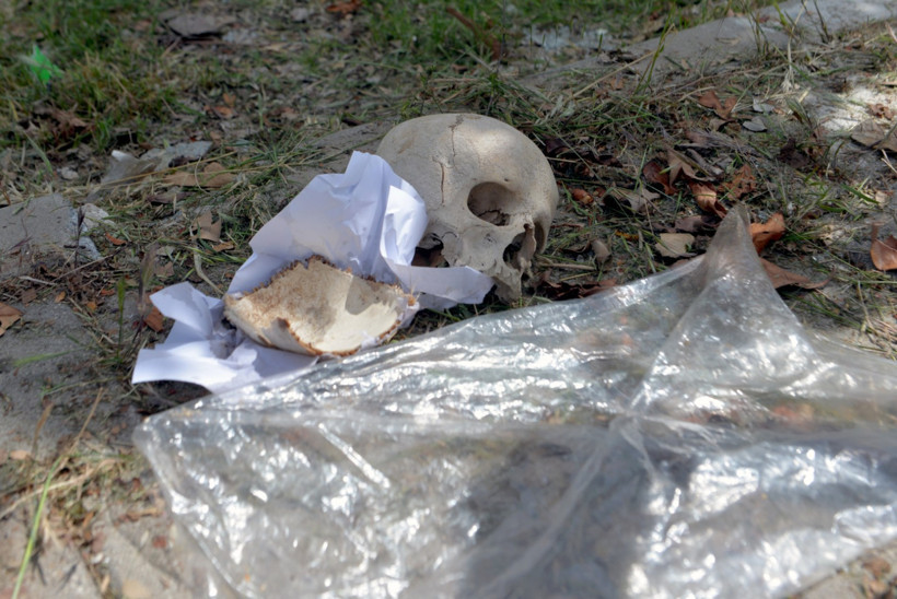 Çöpte bulunan kafatasını, uzman doktorun temizlik yapan eşi atmış - Resim : 2