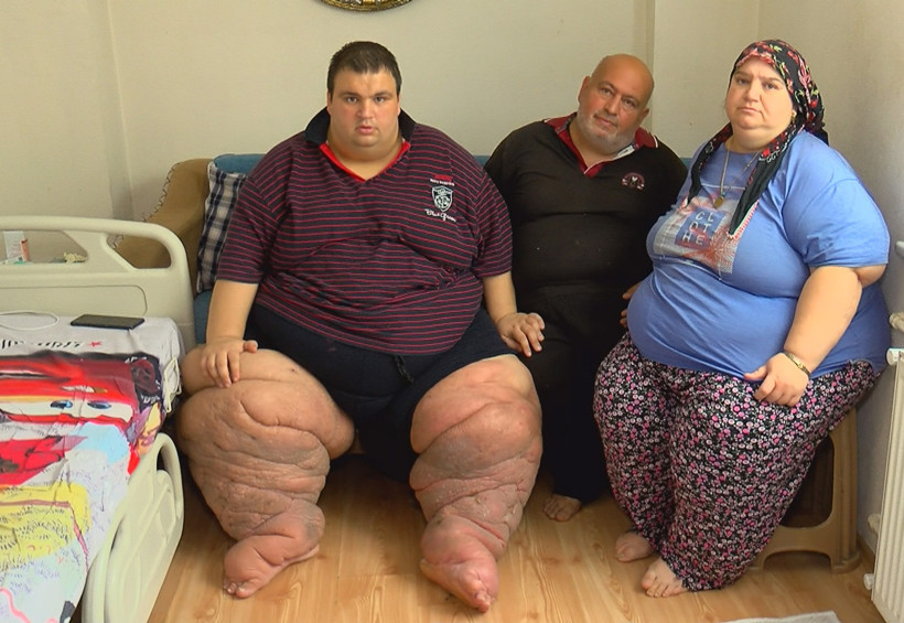 270 kiloya çıkan Mehmet: 15 aydır evden çıkamıyorum, yardım edin - Resim : 1