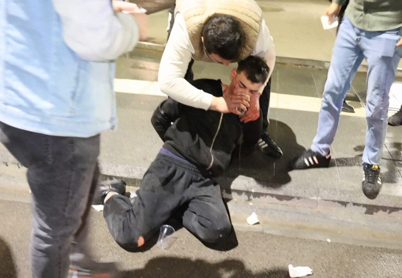 Yasal sınırın 9 katı alkollü sürücünün dişi ağrıyormuş - Resim : 2