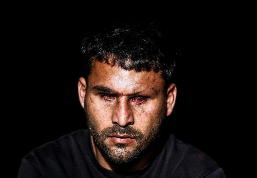 Savaşta iki kez yaralandı, gözlerini kaybetti - Resim: 4