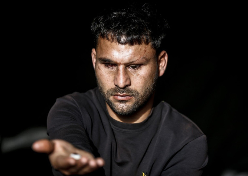 Savaşta iki kez yaralandı, gözlerini kaybetti - Resim: 1