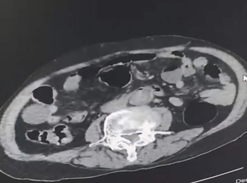 Cinsel organında uyuşturucu ile yakalandı - Resim : 1