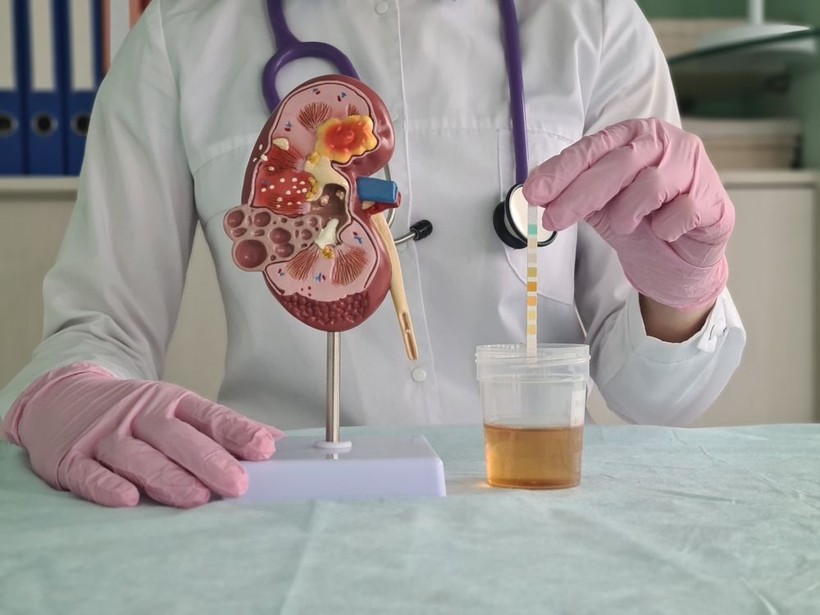 Bilim insanları cevapladı: Vücudunuzun fazladan proteine ihtiyacı var mı? - Resim: 4