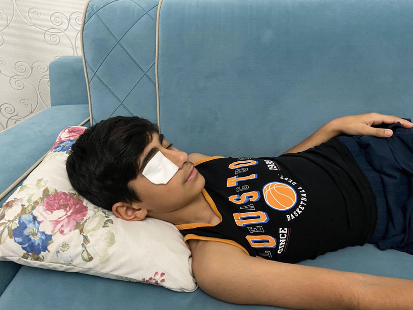 Yapıştırıcı sıçrayınca göz kapağı kapandı, son anda kurtarıldı - Resim : 1