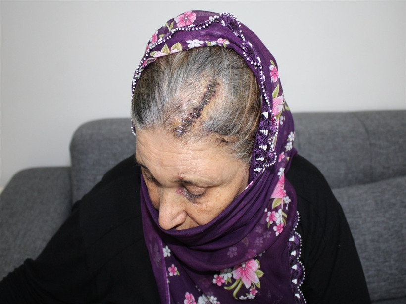 Engelli kızı için merdiven rampa talebi nedeniyle saldırıya uğramıştı: İsteği yerine getirildi - Resim : 2