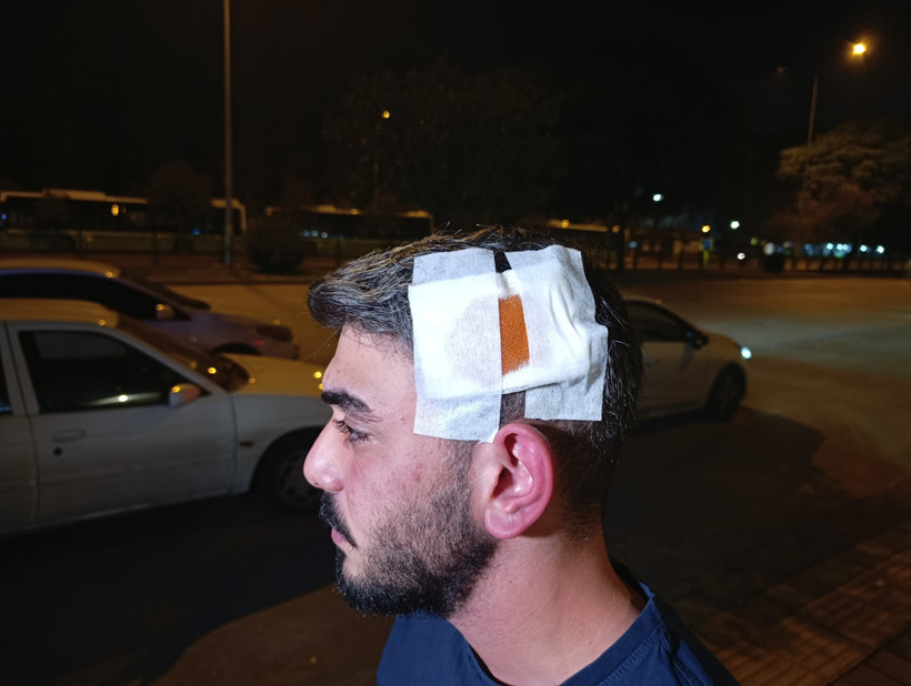 Komşu dehşeti: Babanın dişlerini kırdı, anne ve oğlunu bıçakladı - Resim : 3