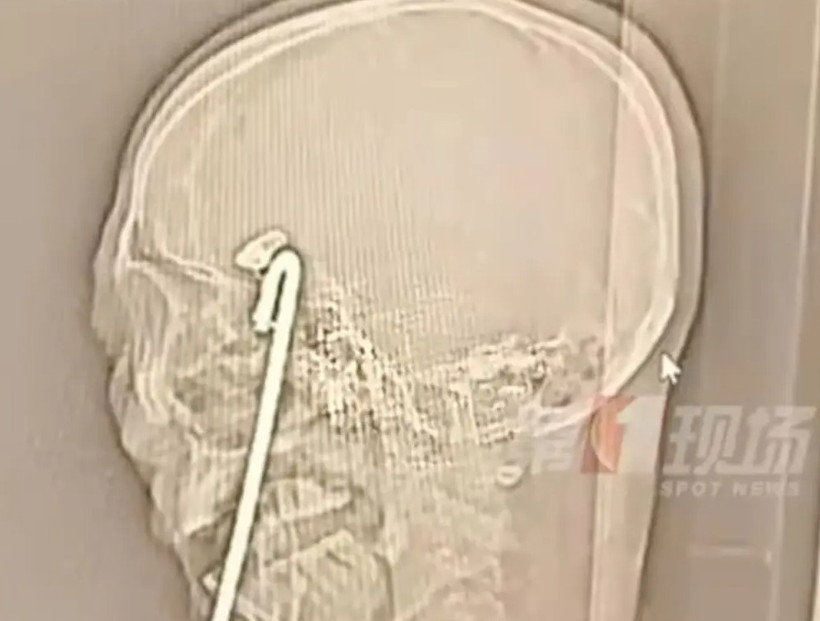 Korkunç olay: Restoranda dengesi bozulunca... - Resim : 1