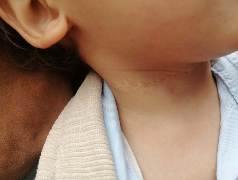 Falçatalı dehşet: 1,5 yaşındaki çocuğun boynunu kesti, evini yakmaya kalktı - Resim : 3