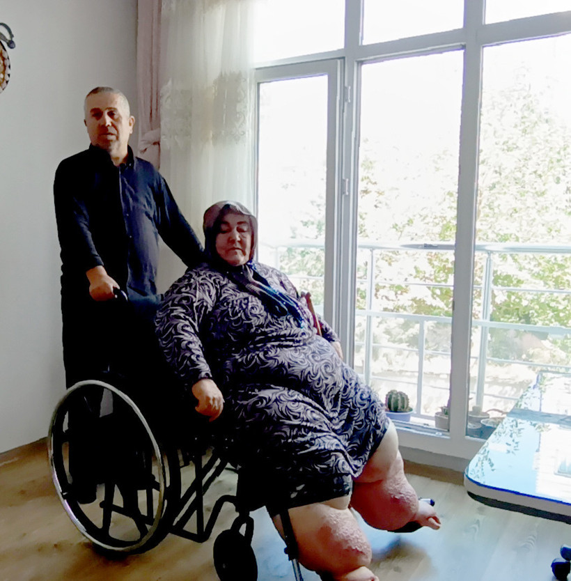 3 yıldır evden çıkamayan fil hastasına tekerlekli sandalye - Resim : 1