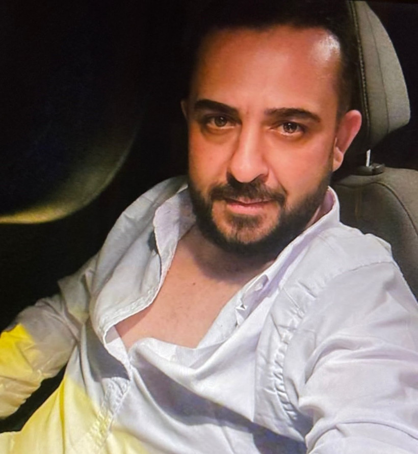 Ekmek teknesi için alevlerin arasına daldı, patlamayla yüzü yandı - Resim : 2